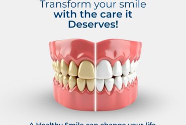 Dentist in Kanpur | Best Dentist in kanpur