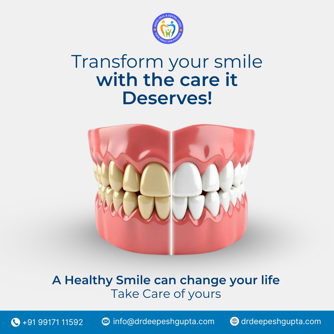 Dentist in Kanpur | Best Dentist in kanpur